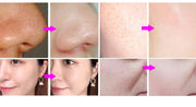 New 7 In 1 Smart Ice Blue Hydra oxyge Dermabrasion Facial Mahcine Skin Cleaning Skin Analyzer Dermabrasion Facial Aquafacial